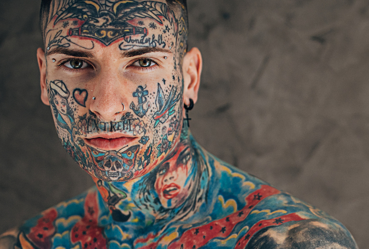 Tattoos and Electrosurgery